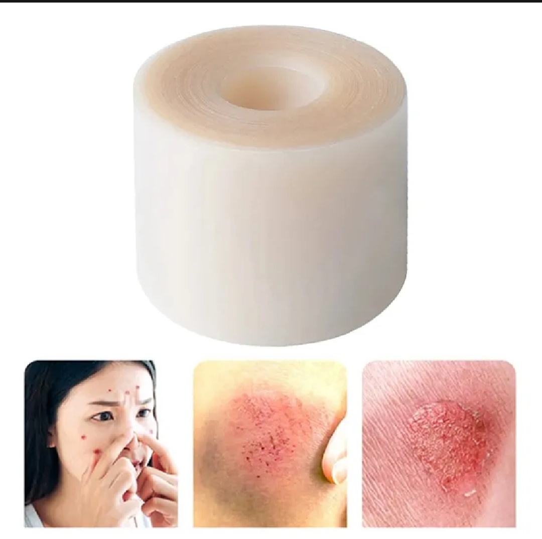 Hydrocolloid Bandage Roll Waterproof Wound Care | Ezikini