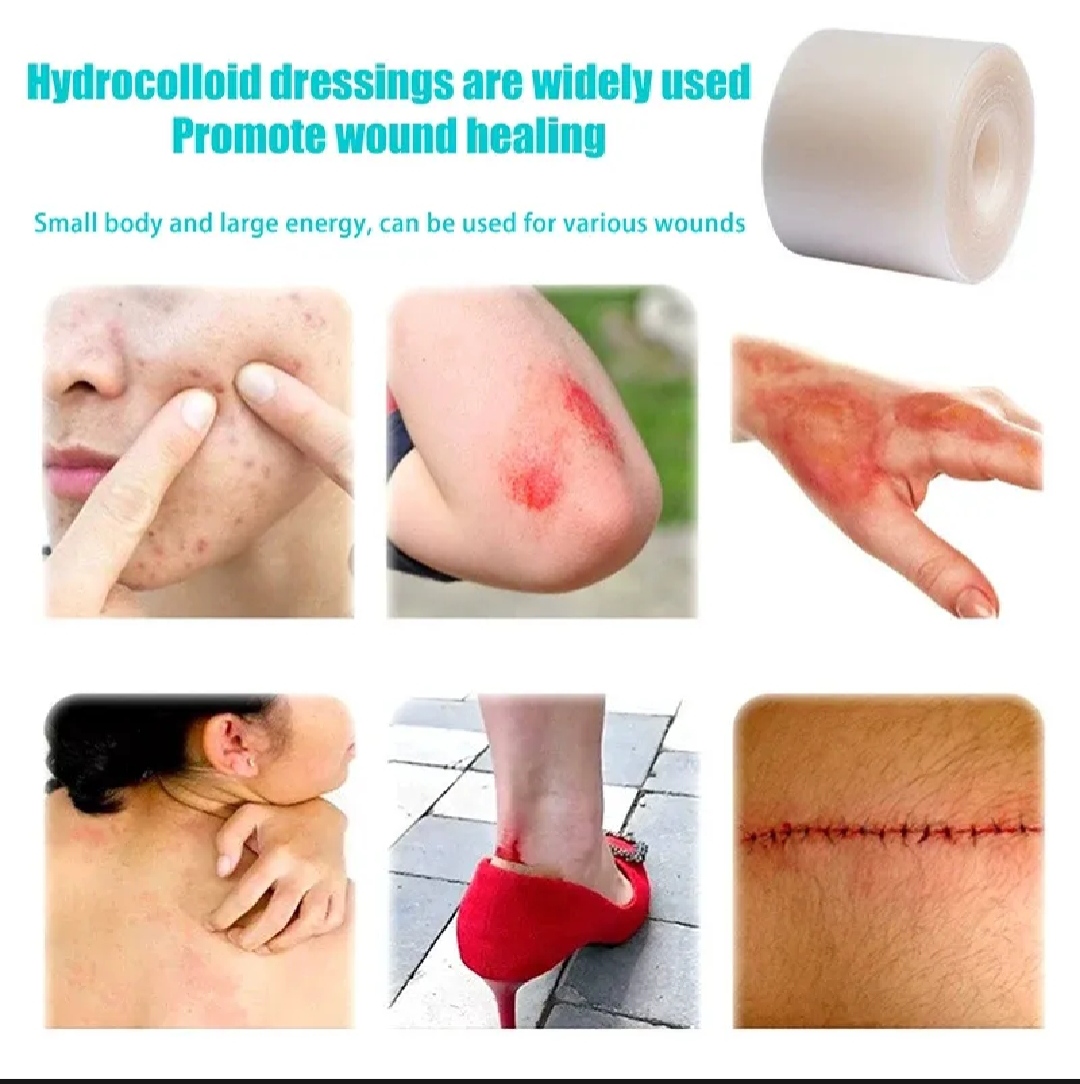 Hydrocolloid Bandage Roll Waterproof Wound Care | Ezikini